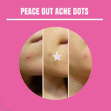 Neva Nude Unicorn Wishes Holographic Iridescent Star Hydrocolloid Acne Pimple Stickers 56 pk